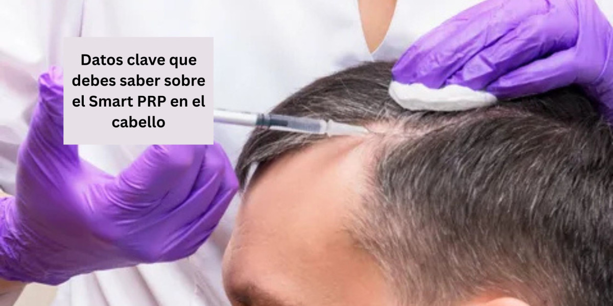 Datos clave que debes saber sobre el Smart PRP en el cabello